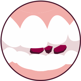 teeth chewing pill
